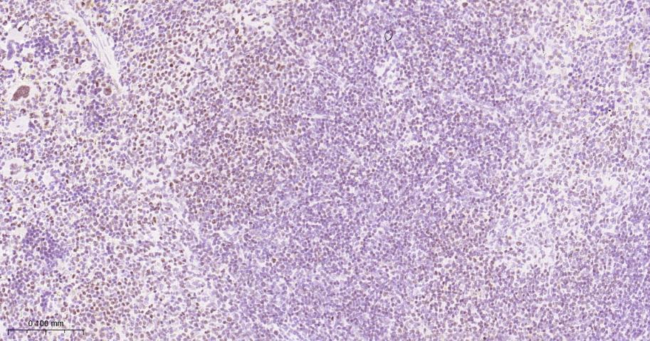 叉头蛋白P1重组兔单抗