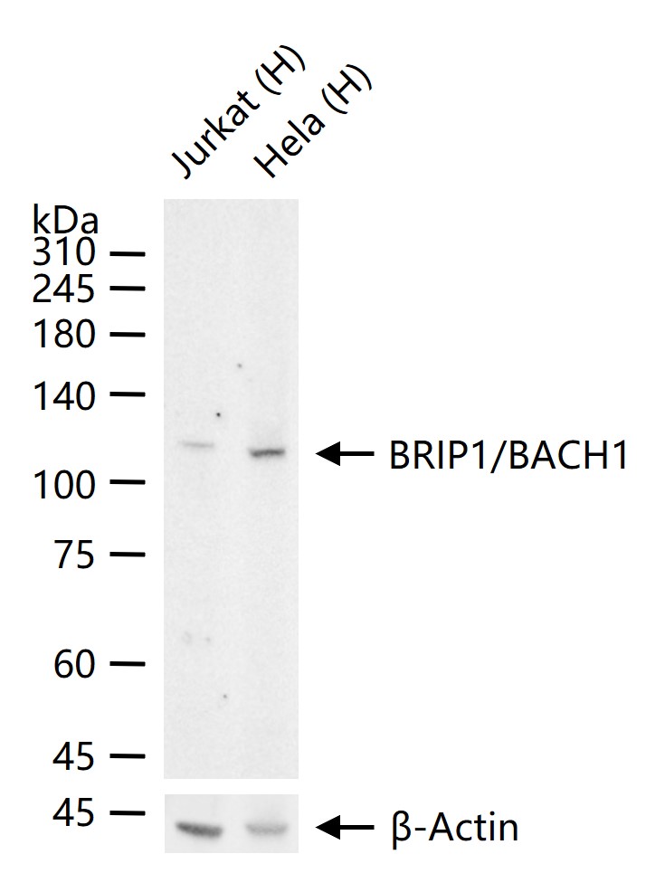 BRIP1/BACH1 Recombinant Rabbit mAb (一抗) - WB | Bioss