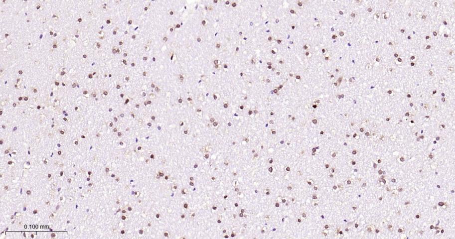 脂肪堆积和肥胖相关蛋白重组兔单抗