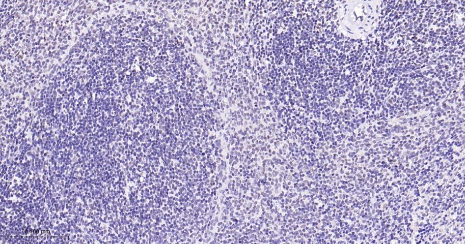 磷酸化p38MAPK重组兔单抗