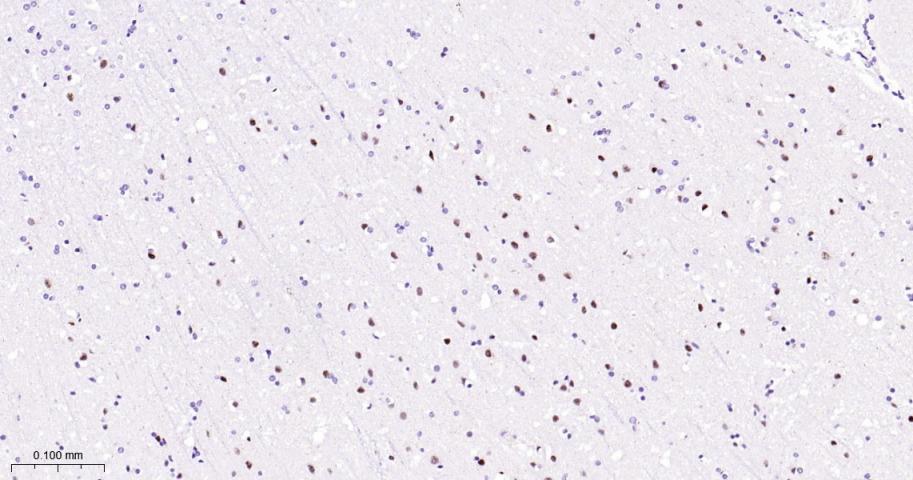 磷酸化p38MAPK重组兔单抗