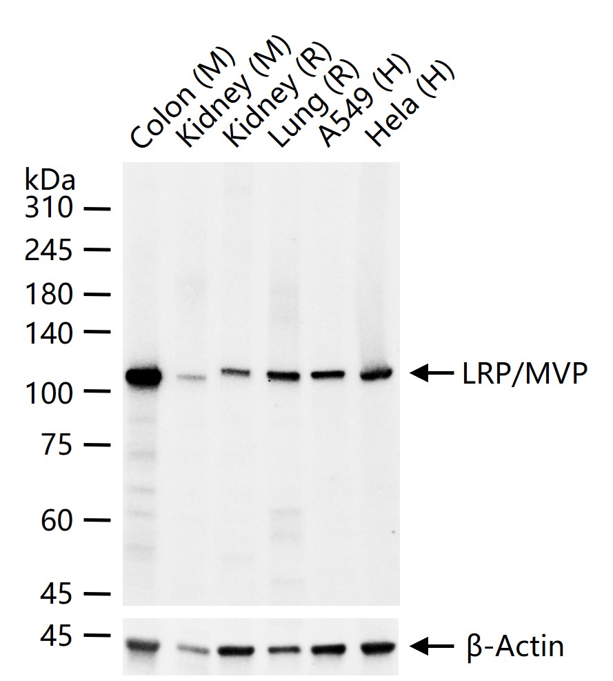 LRP/MVP Recombinant Rabbit mAb (一抗) - WB,IHC-P,IHC-F,IF,Flow-Cyt | Bioss