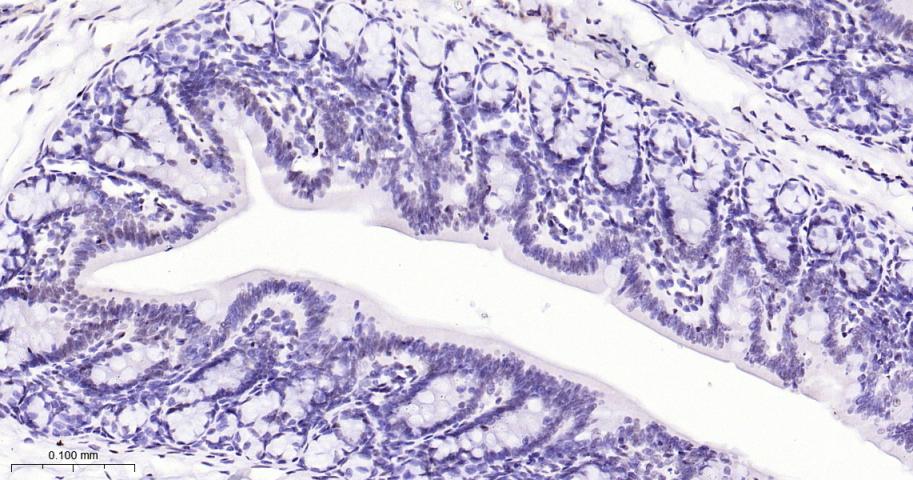 磷酸化p38MAPK重组兔单抗