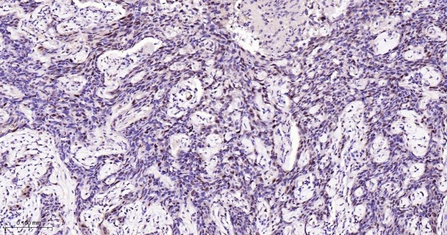 磷酸化p38MAPK重组兔单抗
