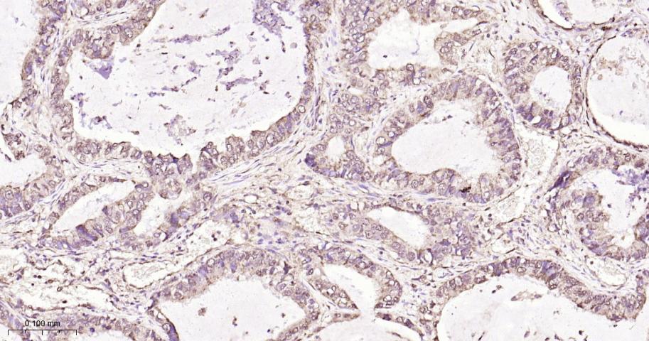 组蛋白去乙酰化酶7重组兔单抗