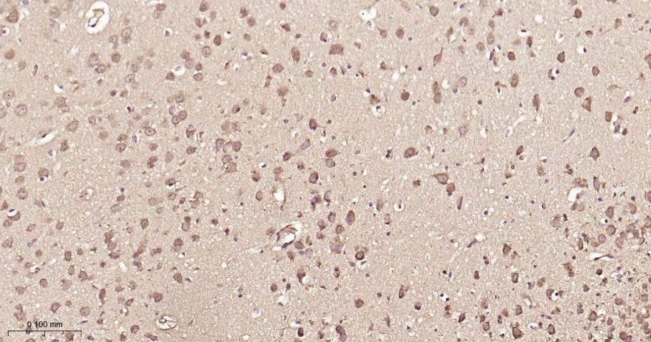 组蛋白去乙酰化酶7重组兔单抗