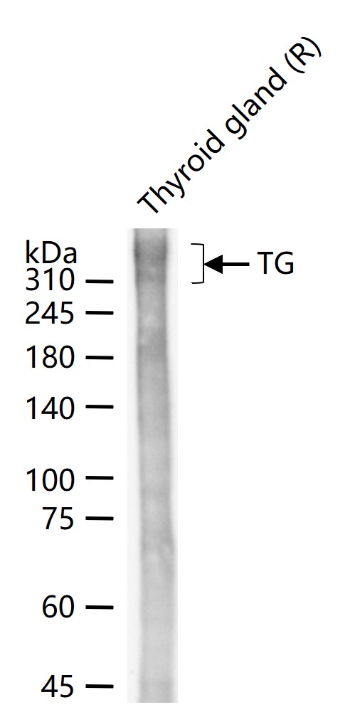 甲状腺球蛋白重组兔单抗