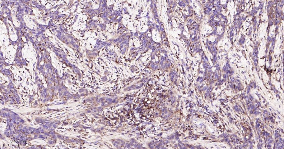 肿瘤坏死因子受体相关因子2重组兔单抗