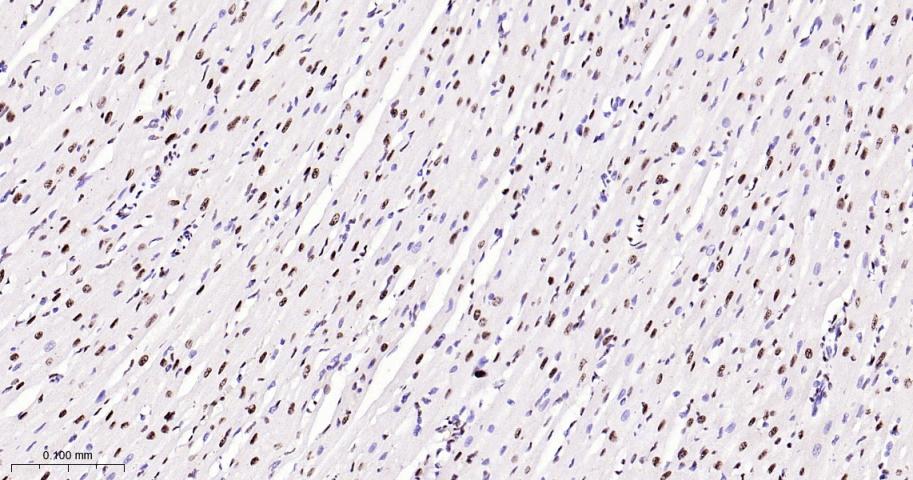磷酸化p38MAPK重组兔单抗