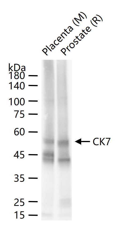 细胞角蛋白7重组兔单抗