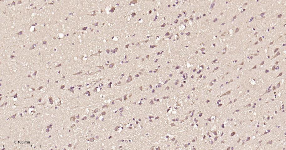 组蛋白去乙酰化酶7重组兔单抗