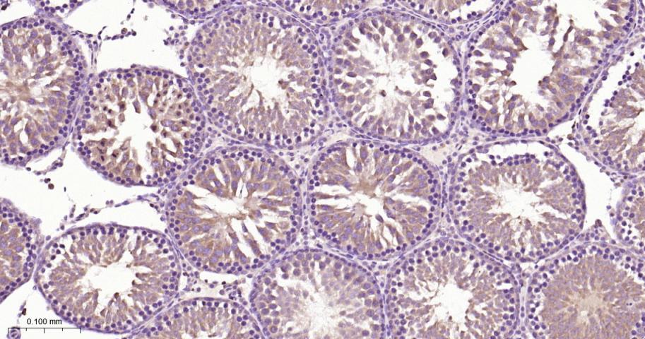 肿瘤坏死因子受体相关因子2重组兔单抗