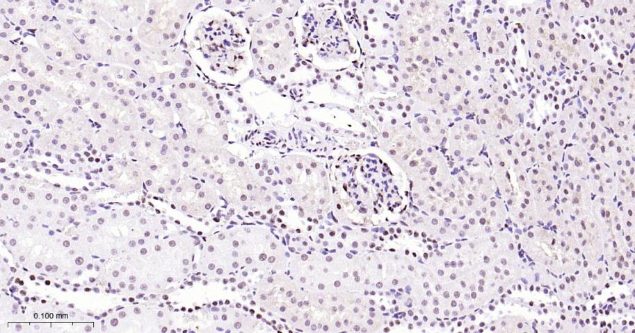 磷酸化p38MAPK重组兔单抗