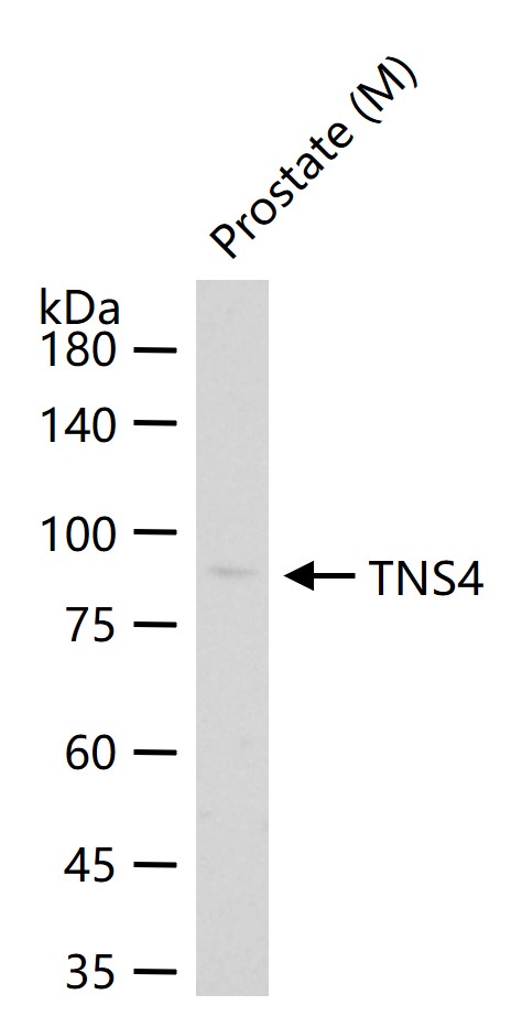 张力蛋白4重组兔单抗