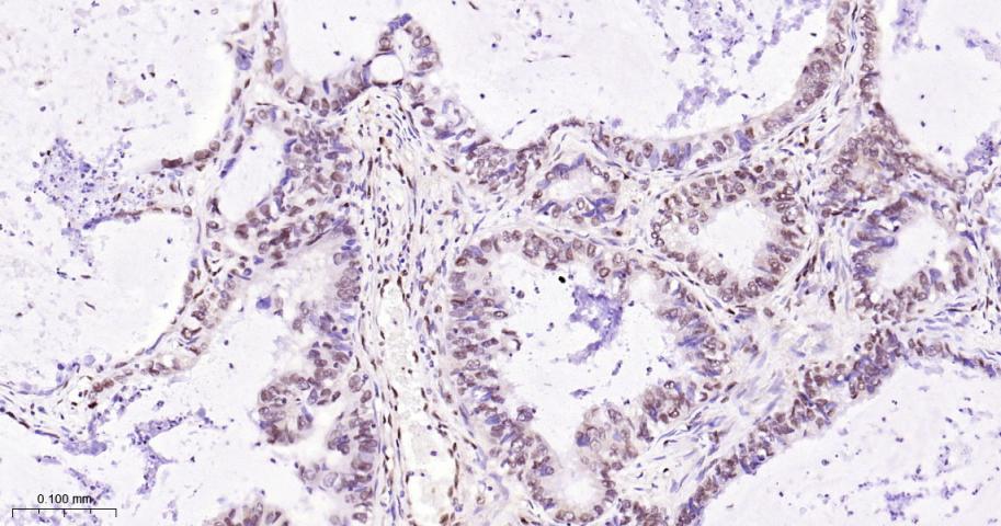 脂肪堆积和肥胖相关蛋白重组兔单抗