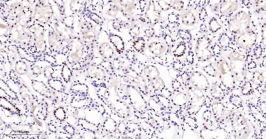 磷酸化p38MAPK重组兔单抗