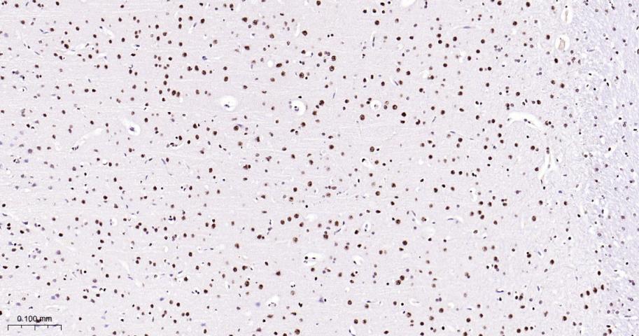 磷酸化p38MAPK重组兔单抗