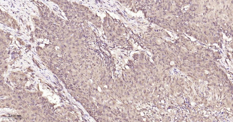 组蛋白去乙酰化酶7重组兔单抗