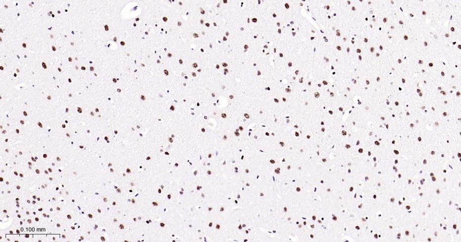 磷酸化p38MAPK重组兔单抗