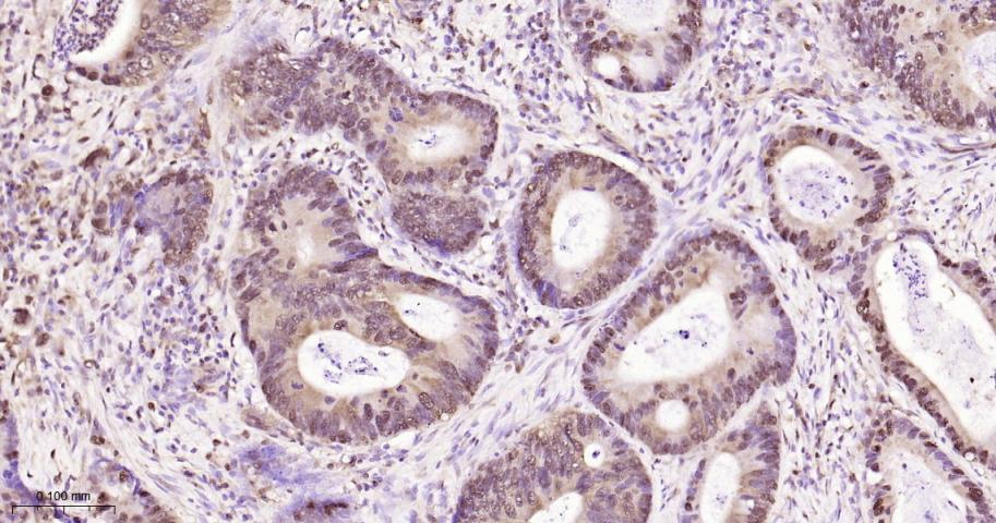 组蛋白去乙酰化酶7重组兔单抗