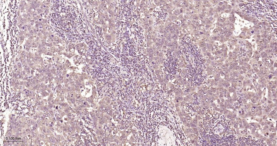 组蛋白去乙酰化酶7重组兔单抗