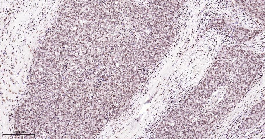 脂肪堆积和肥胖相关蛋白重组兔单抗