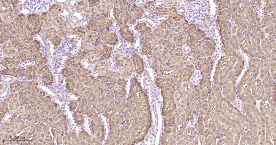 组蛋白去乙酰化酶7重组兔单抗