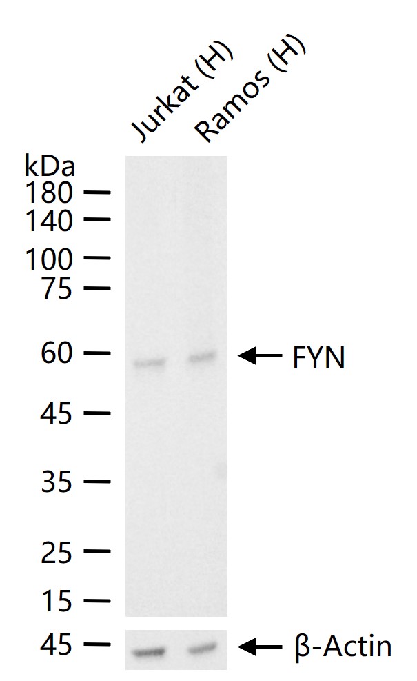 酪氨酸蛋白激酶Fyn/同步原癌基因重组兔单抗