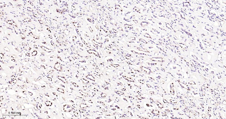 脂肪堆积和肥胖相关蛋白重组兔单抗