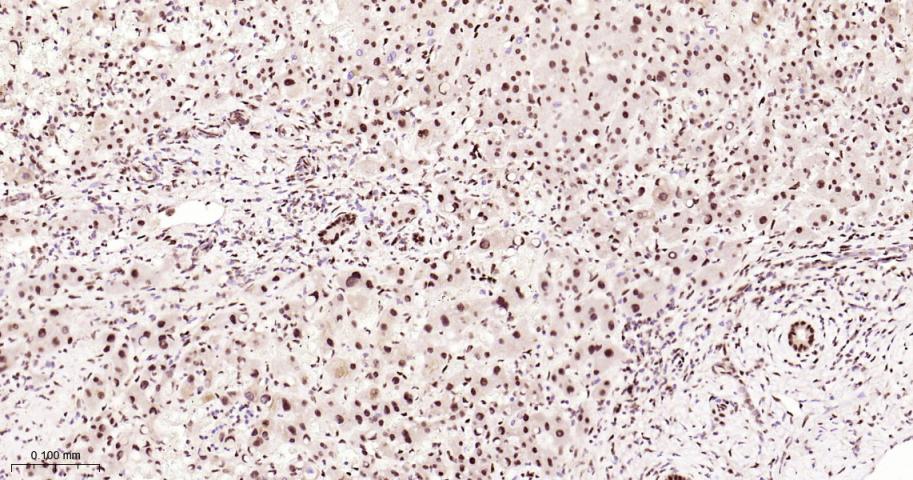 脂肪堆积和肥胖相关蛋白重组兔单抗