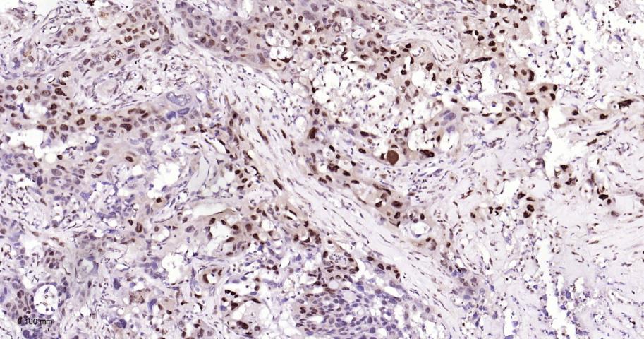 磷酸化p38MAPK重组兔单抗