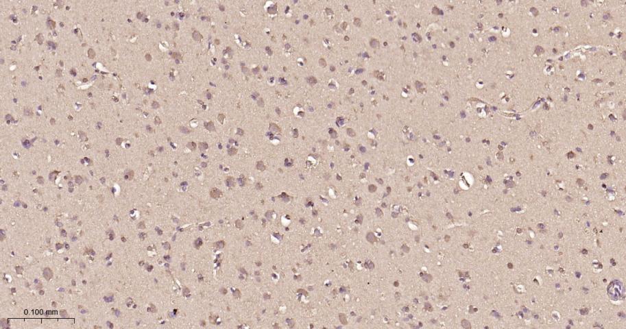 组蛋白去乙酰化酶7重组兔单抗