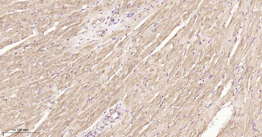组蛋白去乙酰化酶7重组兔单抗
