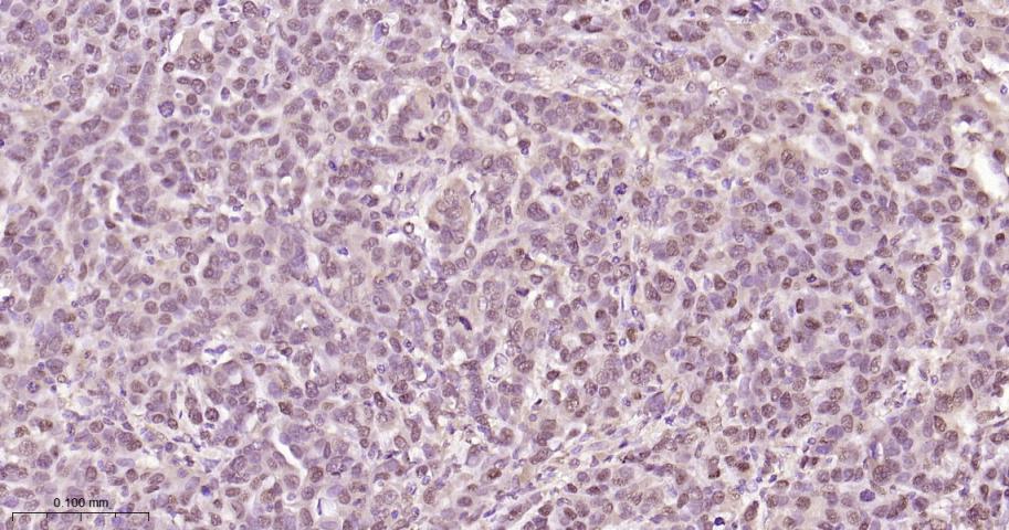 组蛋白去乙酰化酶7重组兔单抗