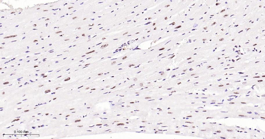 磷酸化p38MAPK重组兔单抗