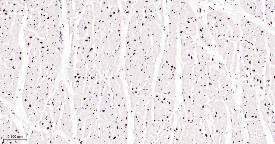 磷酸化p38MAPK重组兔单抗