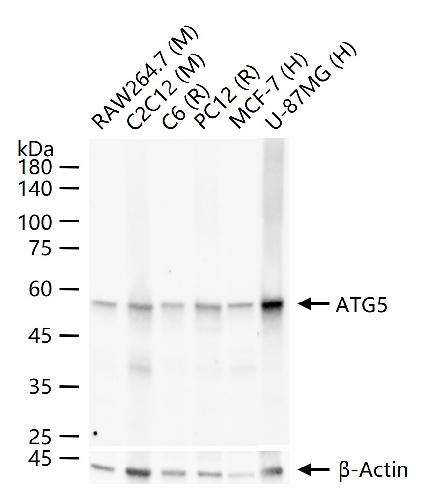 自噬蛋白5重组兔单抗