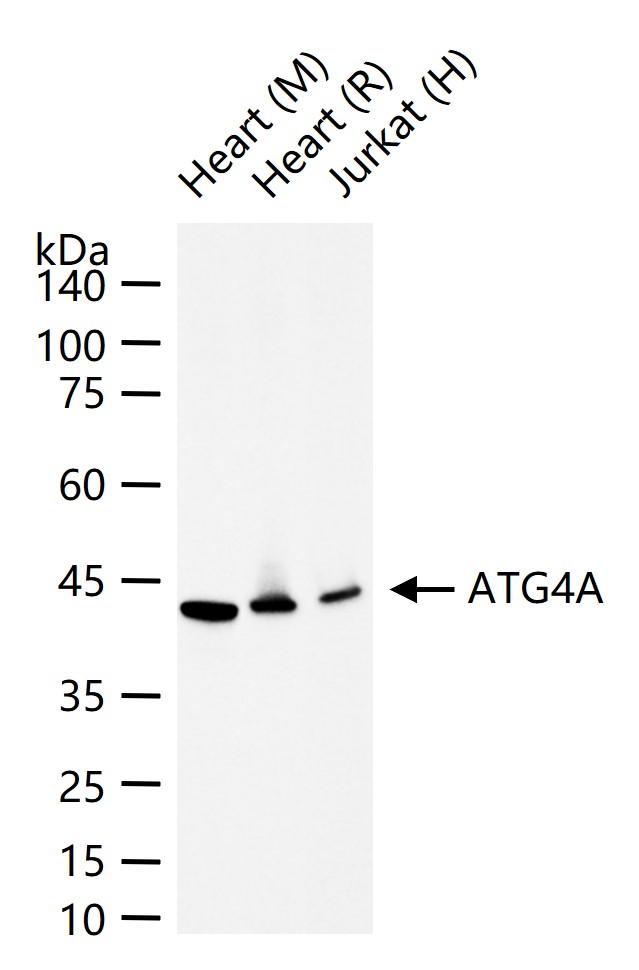 ATG4A Recombinant Rabbit mAb (一抗) - WB,IHC-P,IHC-F,IF,Flow-Cyt,ICC/IF,IP | Bioss