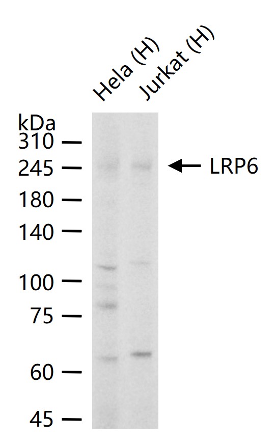低密度脂蛋白受体相关蛋白6重组兔单抗