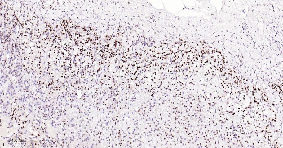 脂肪堆积和肥胖相关蛋白重组兔单抗