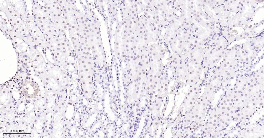 磷酸化p38MAPK重组兔单抗