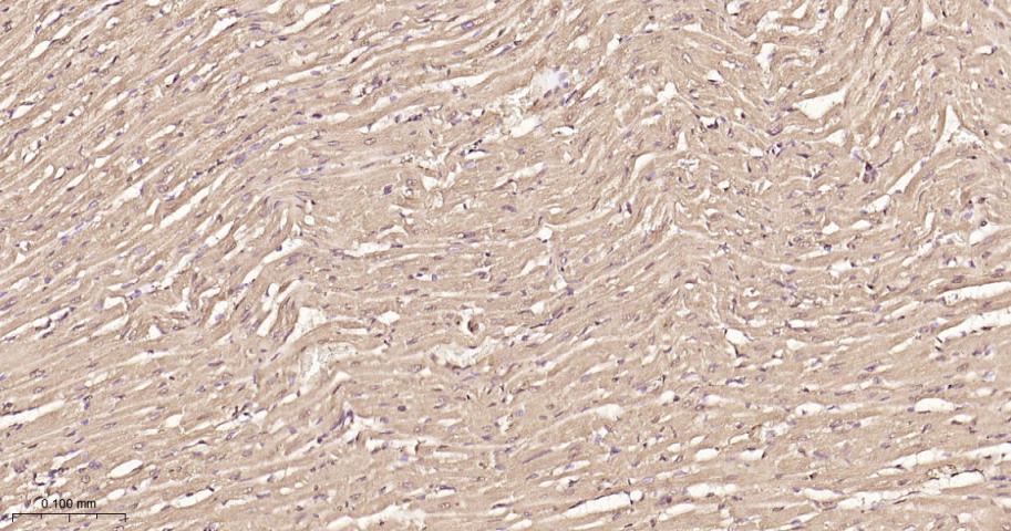 组蛋白去乙酰化酶7重组兔单抗