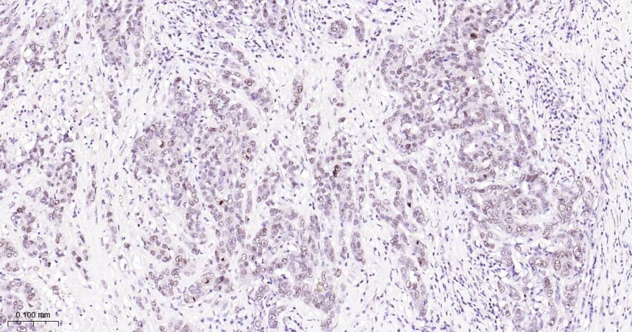 磷酸化p38MAPK重组兔单抗