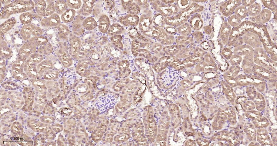 组蛋白去乙酰化酶7重组兔单抗