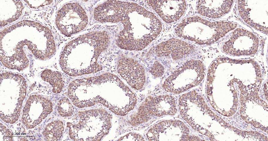 肿瘤坏死因子受体相关因子2重组兔单抗