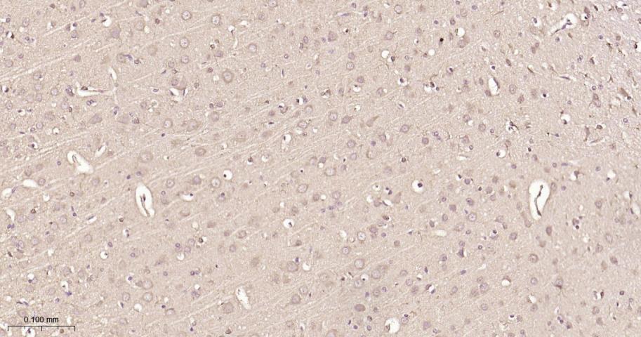 组蛋白去乙酰化酶7重组兔单抗