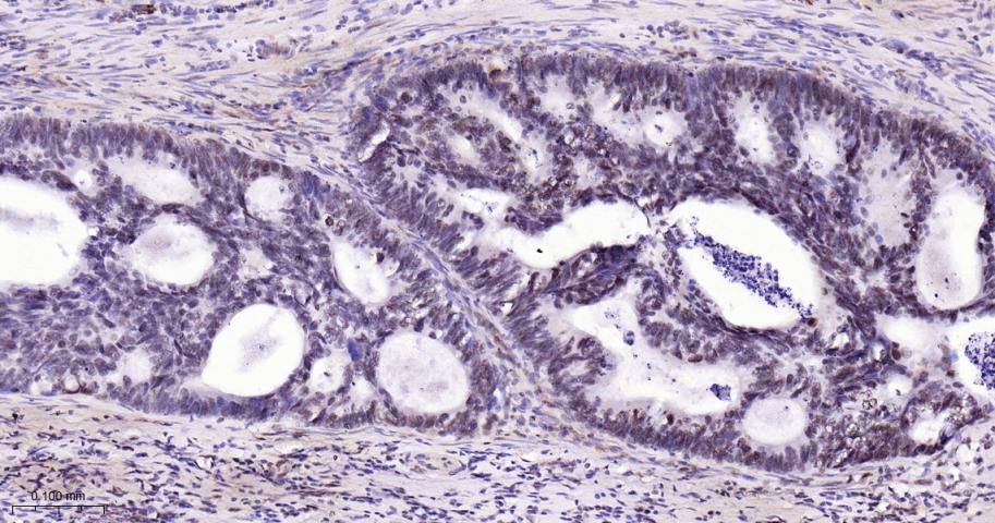 磷酸化p38MAPK重组兔单抗