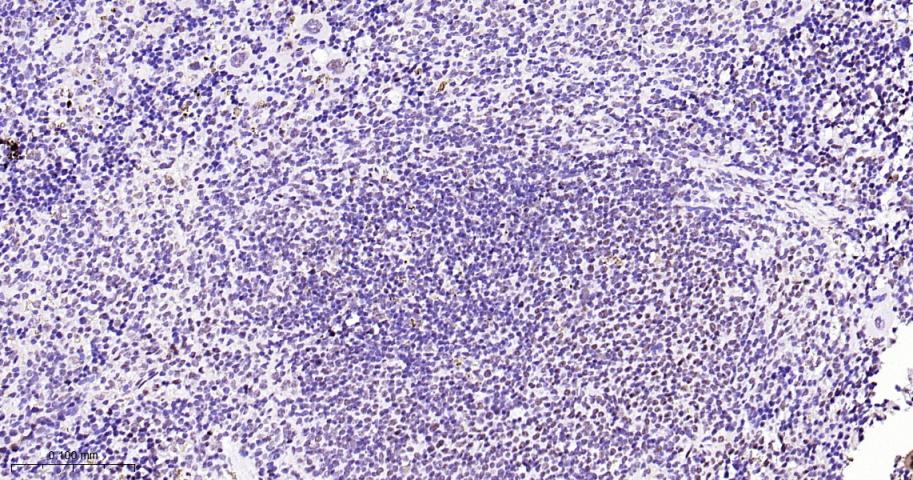 磷酸化p38MAPK重组兔单抗