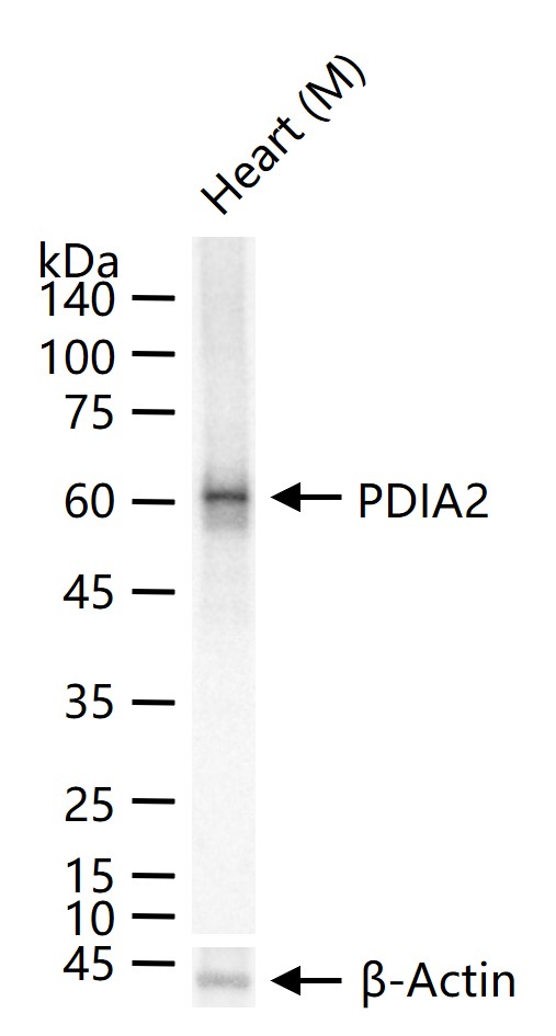 蛋白质二硫键异构酶重组兔单抗