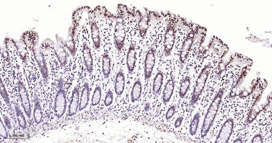 磷酸化p38MAPK重组兔单抗